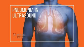 Pneumonia in Ultrasound [upl. by Nybor]