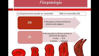 Anemia de celulas falciformes [upl. by Wennerholn937]