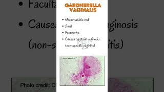 Gardnerella Vaginalis in 1 min bacterialinfections bacterialvaginosis microbiology trending [upl. by Vachill]