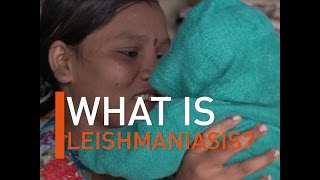 What is Leishmaniasis [upl. by Oicaro]