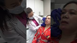 Chin Filler Treatment by Nurse Ami  Ageless MD [upl. by Divan]