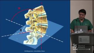 Full Endoscopic Lumbar Surgery Indications Techniques amp Avoiding Complications  James Yue MD [upl. by Cassius580]