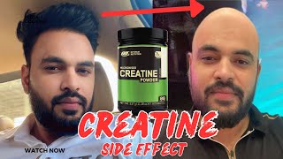 Side Effects of Creatine  Creatine lene sai kya nuksan hote hai  Creatine [upl. by Vod]