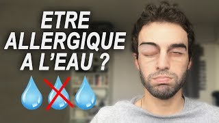 ÊTRE ALLERGIQUE À LEAU  Vrai ou Faux 36 [upl. by Pollard]