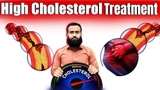 High Cholesterol Treatment  Natural way to lower cholesterol levels [upl. by Mehcanem921]