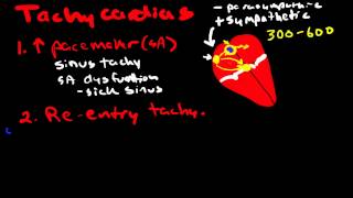 Pathophysiology of Cardiac Arrhythmias [upl. by Macleod]