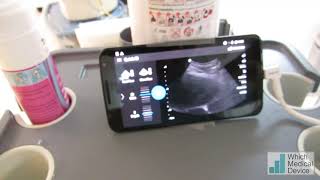 Nephrostomy with your smartphone [upl. by Anikal]