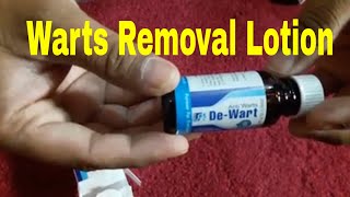 Wart Removal Lotion [upl. by Nohsreg]