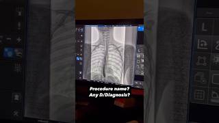 Name The Procedure shorts radiology xray trending viral [upl. by Nimrahc]