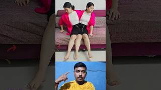 Faded song  Disable handicap two women conjoined three leg 😭 shorts ytshots viralvideo [upl. by Eelsew]