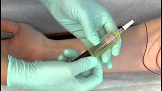 Sample Procedure  Venipuncture Butterfly Method [upl. by Reina]