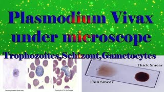 Plasmodium Vivax under microscope TrophozoitesSchizontGametocytesclear explain [upl. by Netneuq]