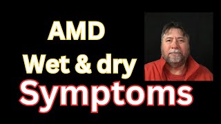 😎 Macular Degeneration Symptoms AMD Wetb amp Dry [upl. by Ofilia]