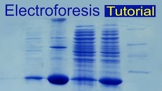 Electroforesis de proteínas tutorial Divulgación científica IQOGCSIC [upl. by Mahgirb]