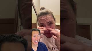 Plastic Surgeon Reacts to DIY Gelatin Face Mask [upl. by Jamie]