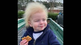 Boy With Rare Uncombable Hair Syndrome Brings a Smile to Faces [upl. by Pessa]