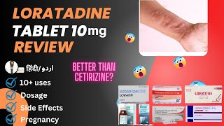 Loratadine  Loratadine 10mg Tablets Used For  Loratadine Tablets 10 mg hindi  Medical Creator [upl. by Yelkao]