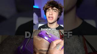 How to get rid of dandruff 😱🤝 [upl. by Sonaj210]