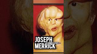 Joseph Merrick storyHOMBRE ELEFANTELEYENDAS E HISTORIASINGLATERRA viralvideo viralshort shorts [upl. by Airotcivairam]