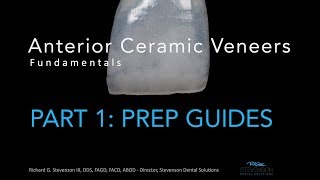 Anterior Ceramic Veneers Part 1 Preparation Guides [upl. by Montague772]