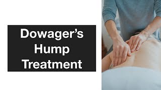 Dowagers Hump Treatment [upl. by Dleifniw]