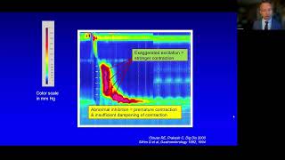 Esophageal Motility Testing in 2024 [upl. by Neils]