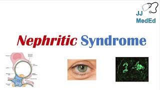 Nephritic Syndrome  Clinical Presentation Causes and Treatment [upl. by Yor]