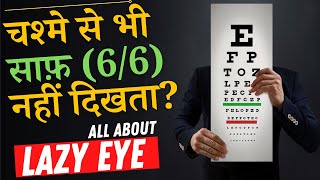 What is A LAZY EYE Amblyopia and How to Fix it  Amblyopia Lazy Eye Causes amp Treatment in Hindi [upl. by Wadlinger]