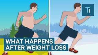 What Losing Weight Does To Your Body And Brain  The Human Body [upl. by Htur311]