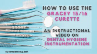 How to use the Gracey 1516 Curette [upl. by Baun]