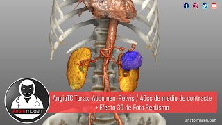 Angio Tomografía de Tórax Abdomen y Pelvis  Efecto Foto Realista [upl. by Niko]