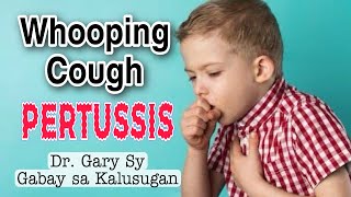 Whooping Cough Pertussis Causes Symptoms amp Treatment  Dr Gary Sy [upl. by Terrej967]