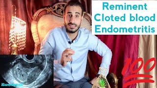 Level 3  Female pelvis  Obs  Emergency  Post abortion Reminent vs cloted blood [upl. by Beau]