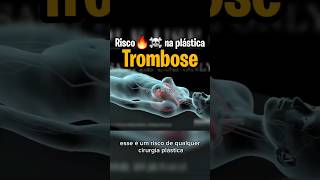 TROMBOSE E EMBOLIA 🔥RISCO DE QUALQUER CIRURGIA PLÁSTICA OU NÃO riscos emboliapulmonar trombose [upl. by Nonac585]