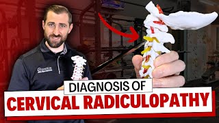 Diagnosing Cervical Radiculopathy Special Tests amp Clinical Insights  Clinical Examination [upl. by Benedicto281]