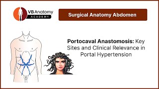 Portocaval Anastomosis Key Sites and Clinical Relevance in Portal Hypertension [upl. by Jozef]