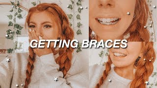 GETTING BRACES at 23 finally [upl. by Einor]