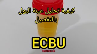 ECBU طريقة تحليل عينة البول بالتفصيل [upl. by Asiulairam321]