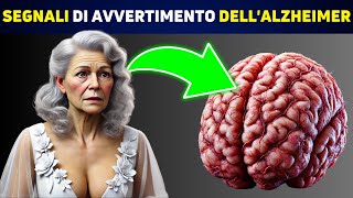 SCIENTIFICO Queste 5 Abitudini Sono Legate allAlzheimer [upl. by Ayikan]