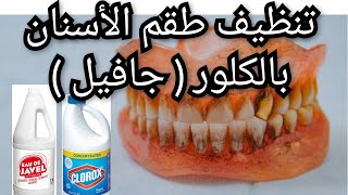 تنظيف طقم الاسنان المتحرك بالكلور  جافيل  المبيضNettoyage de prothèse dentaire amovible avec Javel [upl. by Iliram]