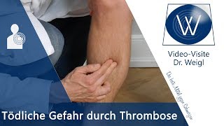 Die tödliche Gefahr durch Thrombose  Ursachen Symptome amp Tipps bei tiefer Beinvenenthrombose TVT [upl. by Remark283]