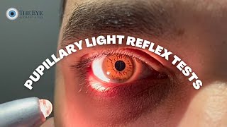 Pupillary Light Reflex Tests [upl. by Brace344]