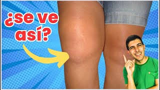 🚩ESTO NO DEBES HACER SI TIENES INFLAMADA LA RODILLA [upl. by Bradwell]