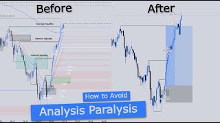 How to Avoid Analysis Paralysis in Day Trading [upl. by Nirrek190]