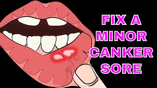 How to naturally fix for a canker sore in less than 4 minutes [upl. by Shina398]