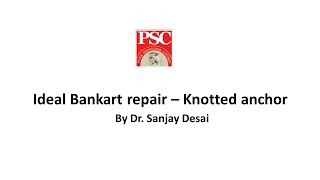 Ideal Bankart repair – Knotted anchor By Dr Sanjay Desai [upl. by Middle]