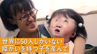 【「こんなかわいい子はいない」】世界的に稀少な染色体異常を持つ子と生きるお母さんの一日 supported by にしたんクリニック [upl. by Lauryn]