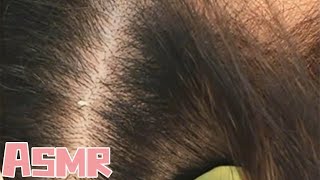 ASMR丨Mens scalp care immersive cleaning antiitching [upl. by Okomom]