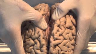 Introduction Neuroanatomy Video Lab  Brain Dissections [upl. by Arihat]