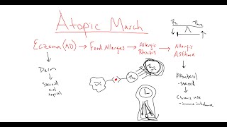 Atopic March  what causes it and what can you do about it [upl. by Dillie]